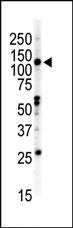 Anti-EPHB2 Rabbit Polyclonal Antibody