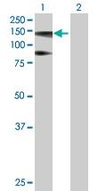 Anti-HIP1R Mouse Polyclonal Antibody