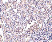 Anti-LY96 Mouse Monoclonal Antibody [clone: 1A2E3]