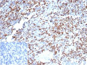 Anti-OCT-2 Rabbit Recombinant Antibody [clone: OCT2/7073R]