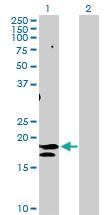 Anti-ST6GAL1 Rabbit Polyclonal Antibody