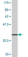 Anti-TCEAL1 Mouse Monoclonal Antibody [clone: 2B5]