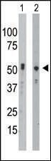 Anti-BCKDK Rabbit Polyclonal Antibody (FITC (Fluorescein))