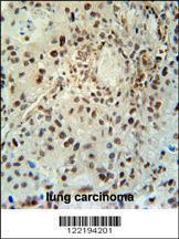 Anti-ABHD14B Rabbit Polyclonal Antibody (APC (Allophycocyanin))