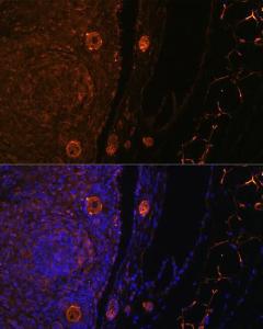 Immunofluorescence analysis of rat oophoroma cells using Anti-ZP3 Antibody (A10401) at a dilution of 1:100. DAPI was used to stain the cell nuclei (blue)