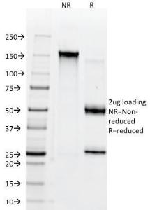 SDS-PAGE analysis of Anti-CD38 Antibody [AT1] under non-reduced and reduced conditions; showing intact IgG and intact heavy and light chains, respectively. SDS-PAGE analysis confirms the integrity and purity of the Antibody