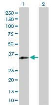 Anti-RFXAP Rabbit Polyclonal Antibody