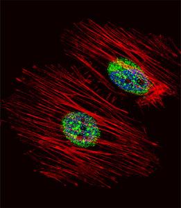 Anti-NME2 Rabbit Polyclonal Antibody (AP (Alkaline Phosphatase))