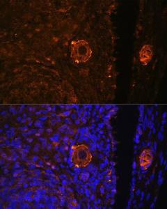 Immunofluorescence analysis of rat oophoroma cells using Anti-ZP3 Antibody (A10401) at a dilution of 1:100. DAPI was used to stain the cell nuclei (blue)