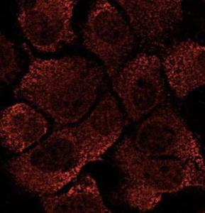 Hepa 1-6 cells stained with Anti-EEA1 Antibody at a 1:50 dilution