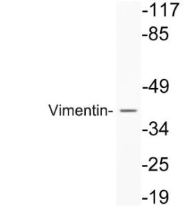 Western blot analysis of lysate from A549 cells using Anti-Vimentin Antibody