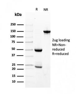 SDS-PAGE analysis of Anti-Transthyretin Antibody [TTR/4296] under non-reduced and reduced conditions; showing intact IgG and intact heavy and light chains, respectively. SDS-PAGE analysis confirms the integrity and purity of the antibody.