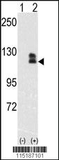 Anti-EPHB2 Rabbit Polyclonal Antibody