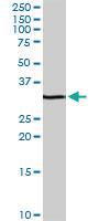 Anti-RFXAP Rabbit Polyclonal Antibody