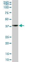 Anti-ST6GAL1 Rabbit Polyclonal Antibody