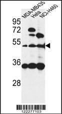 Anti-ISLR Rabbit Polyclonal Antibody (PE (Phycoerythrin))