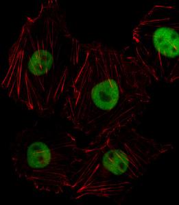 Anti-HOXD8 Rabbit Polyclonal Antibody (Biotin)