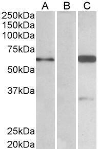 HEK293 lysate (10ug protein in RIPA buffer) over expressing Human BAIAP2 with DYKDDDDK tag probed with Anti-BAIAP2 Antibody (A82471) (1