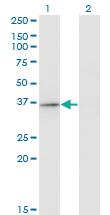 Anti-RFXAP Mouse Monoclonal Antibody [clone: 1B5]