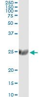 Anti-ST6GAL1 Mouse Monoclonal Antibody [clone: 2E12]