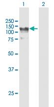 Anti-HIP1R Rabbit Polyclonal Antibody