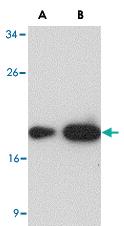 Anti-LY96 Mouse Monoclonal Antibody [clone: 1A2E3]