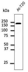 Endogenous EEA1 detected with Anti-EEA1 Antibody at a 1:500 dilution. Lysates at 100 µg per lane and rabbit anti-goat IgG Antibody (HRP) at a 1:10000 dilution