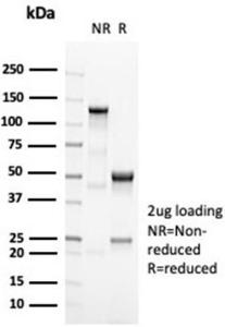 Anti-OCT-2 Rabbit Recombinant Antibody [clone: OCT2/7073R]