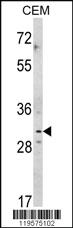 Anti-CNOT8 Rabbit Polyclonal Antibody