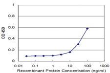 Anti-RFXAP Mouse Monoclonal Antibody [clone: 1B5]