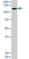 Anti-HIP1R Rabbit Polyclonal Antibody