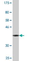 Anti-VASH1 Mouse Monoclonal Antibody [clone: 4A3]