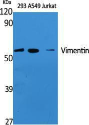 Western blot analysis of various cells using Anti-Vimentin Antibody