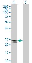 Anti-RGS1 Mouse Polyclonal Antibody