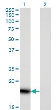 Anti-PLA2G16 Mouse Monoclonal Antibody [clone: 4C4-2A11]