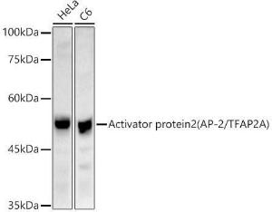 Western blot analysis of extracts of various cell lines, using Anti-Transcription factor AP-2-alpha Antibody (A308526) at 1:1,000 dilution The secondary antibody was Goat Anti-Rabbit IgG H&L Antibody (HRP) at 1:10,000 dilution Lysates/proteins were present at 25 µg per lane