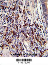 Anti-CNOT8 Rabbit Polyclonal Antibody