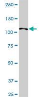 Anti-HIP1R Rabbit Polyclonal Antibody