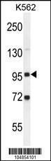 Anti-GPLD1 Rabbit Polyclonal Antibody (AP (Alkaline Phosphatase))