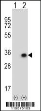 Anti-CNOT8 Rabbit Polyclonal Antibody