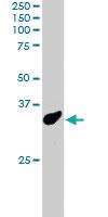 Anti-PCGF3 Goat Polyclonal Antibody