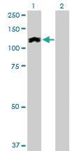 Anti-HIP1R Rabbit Polyclonal Antibody