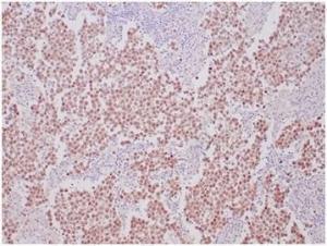 Immunohistochemical analysis of formalin-fixed, paraffin-embedded human se minoma tissue using Anti-OCT-4 Antibody [OCT4/6875R]