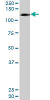 Anti-HIP1R Rabbit Polyclonal Antibody