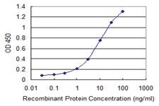 Anti-PLA2G16 Mouse Monoclonal Antibody [clone: 4C4-2A11]