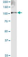 Anti-EXT2 Mouse Monoclonal Antibody [clone: 3G6]