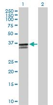 Anti-ST3GAL2 Mouse Polyclonal Antibody