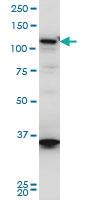 Anti-HIP1R Mouse Monoclonal Antibody [clone: 3E10]