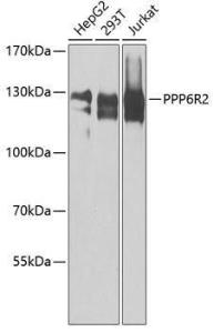 Anti-PPP6R2 Antibody (A8359)