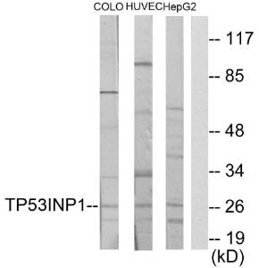 Western blot analysis of lysates from COLO205, HUVEC, and HepG2 cells using Anti-TP53INP1 Antibody. The right hand lane represents a negative control, where the Antibody is blocked by the immunising peptide